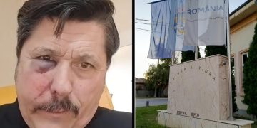 Au atacat cu ura voiau sa ma ucid Un consilier local AUR a ajuns la spital cu o fractura faciala