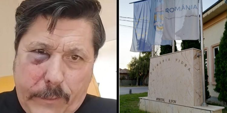 Au atacat cu ura voiau sa ma ucid Un consilier local AUR a ajuns la spital cu o fractura faciala